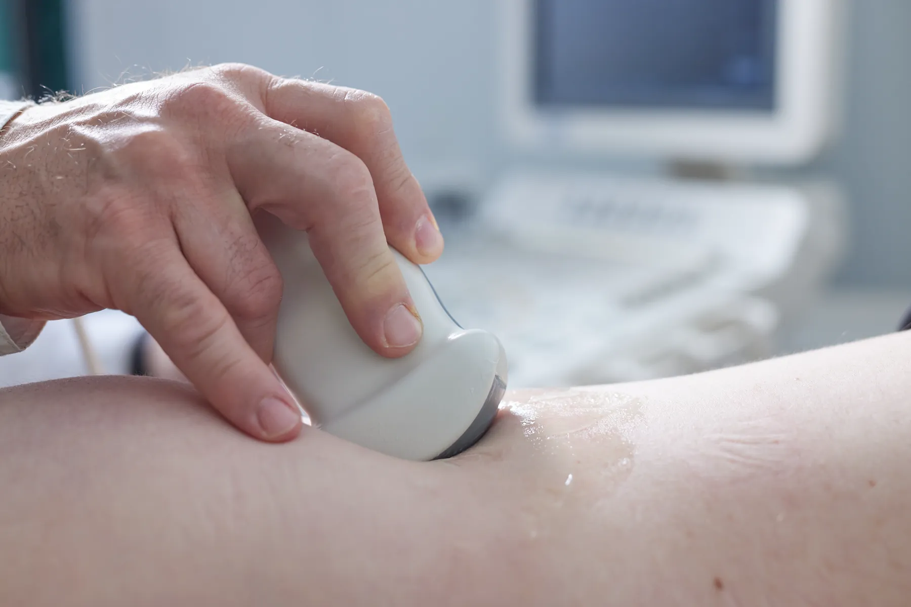 Color doppler pregled u tijeku